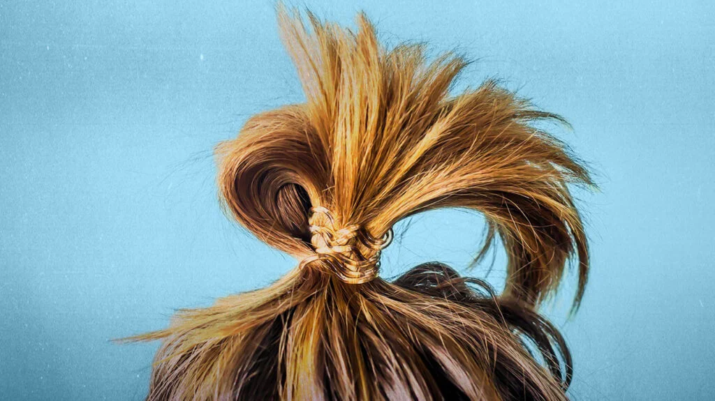 How Long Do Cannabis Edibles Remain Detectable in Hair Follicles 
